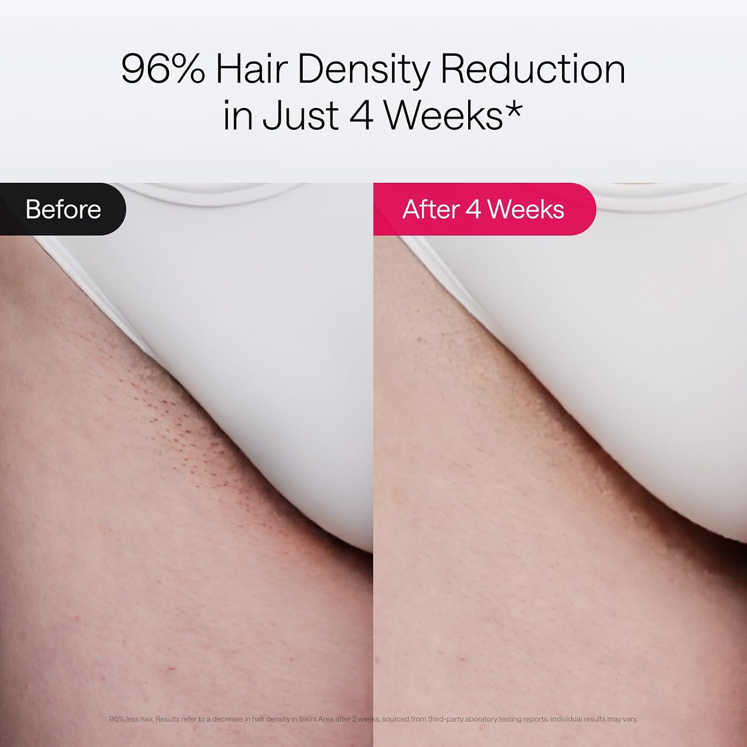 Ulike Laser Hair Removal Air 10 Deluxe Version IPL for for Women and Men with Ice-Cooling Technology, Nealy Painless and Permanent Hair Reduction, at Home Hair Removal in 10mins with Skin Sensor - Image 4