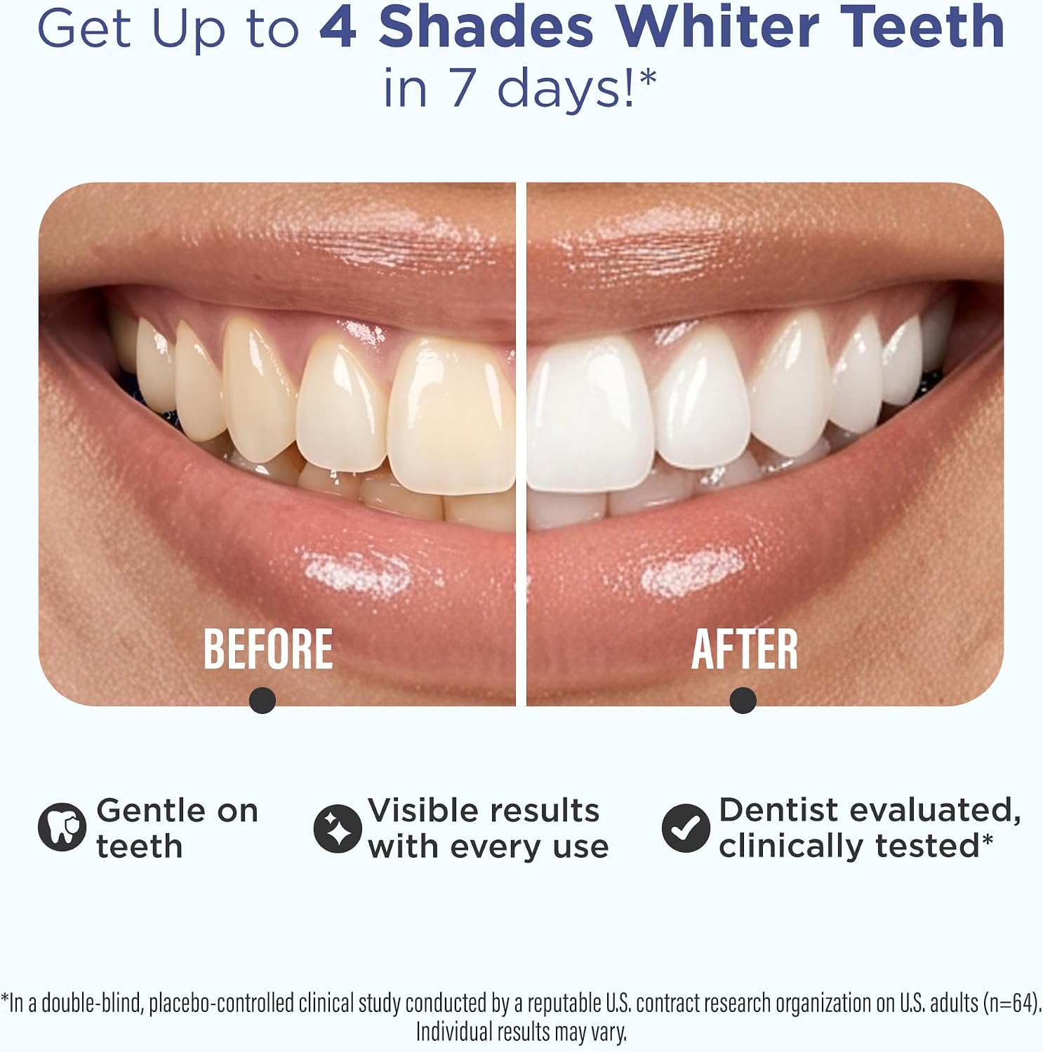 GuruNanda Teeth Whitening Strips - 4X Whiter Teeth, 7-Day Whitening Kit - Image 2