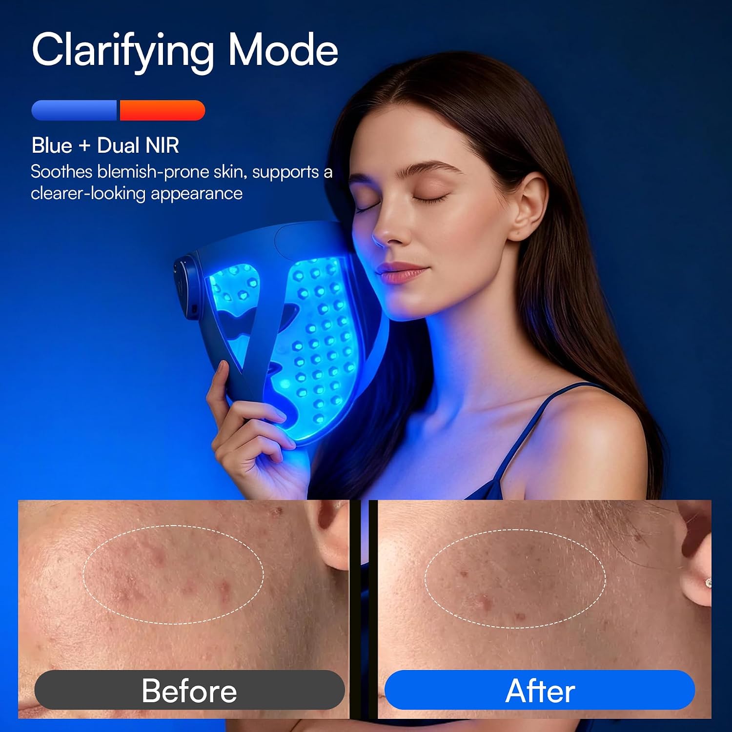 INIA GLOW 4D Wireless Red Light Therapy Mask for Face, Dual NIR, 320 LEDs - Image 5