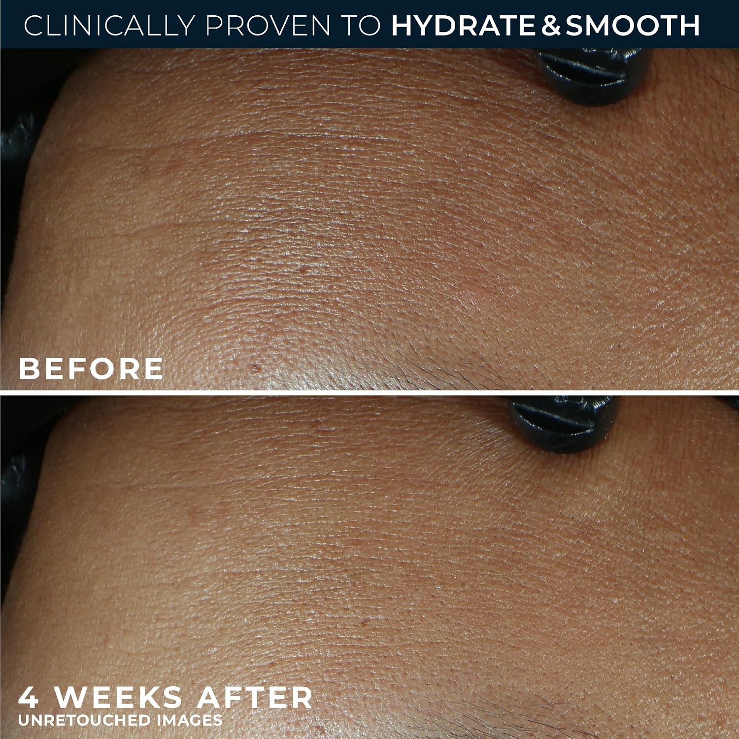 RoC Retinol Correxion Max Daily Hydration Face Moisturizer, Hyaluronic Acid - Image 4