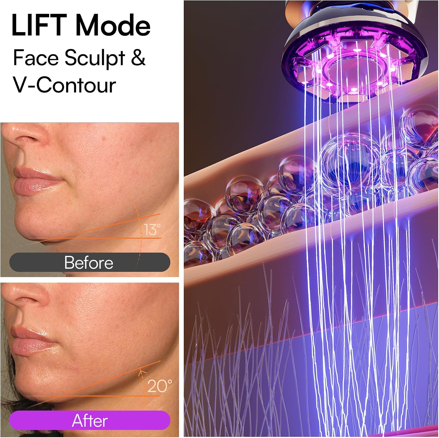 INIA FLARE 3-in-1 Microcurrent Facial Device Red Light Therapy for Face - Image 3