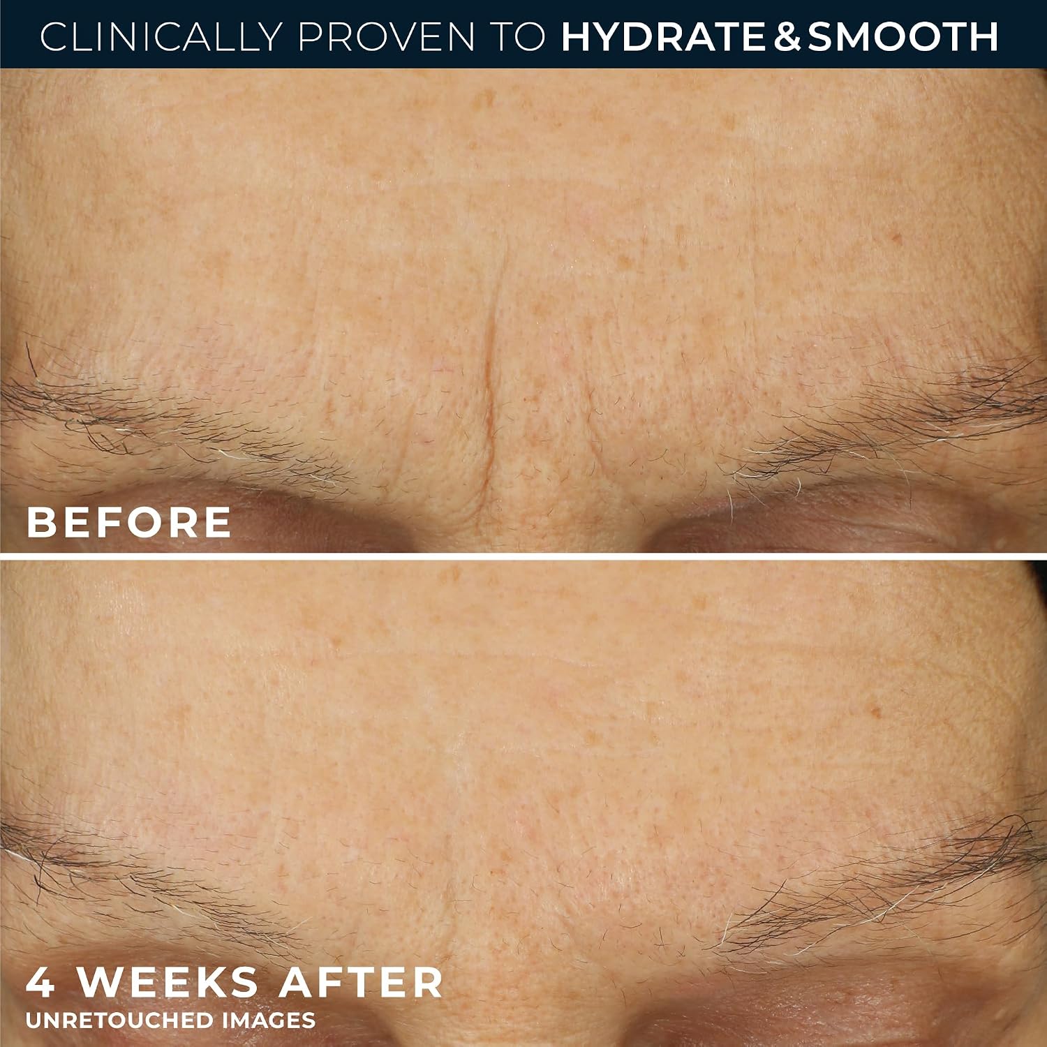 RoC Retinol Correxion Max Daily Hydration Face Moisturizer, Hyaluronic Acid - Image 5